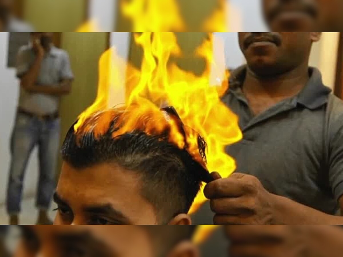 Fire Haircut: शख्स को फायर हेयरकट करवाना पड़ा महंगा, बुरी तरह झुलसा