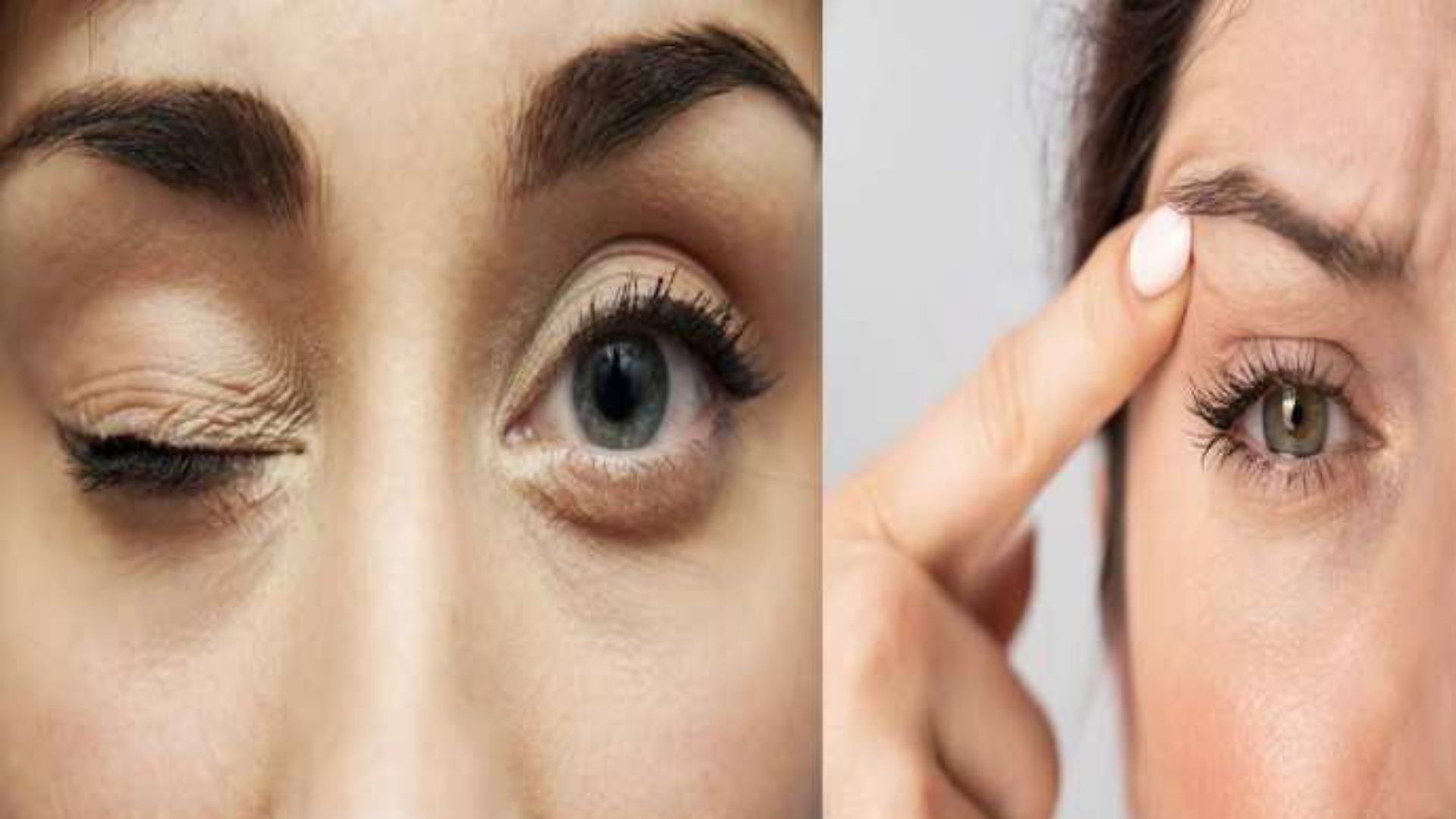 Eyes flutter do not ignore twitching serious symptoms of disease eye