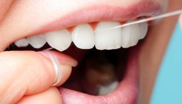  Home Remedy: दांतों के पीलेपन से परेशान? इस फल के छिलके से सफेद चमकने लगेंगे दांत
