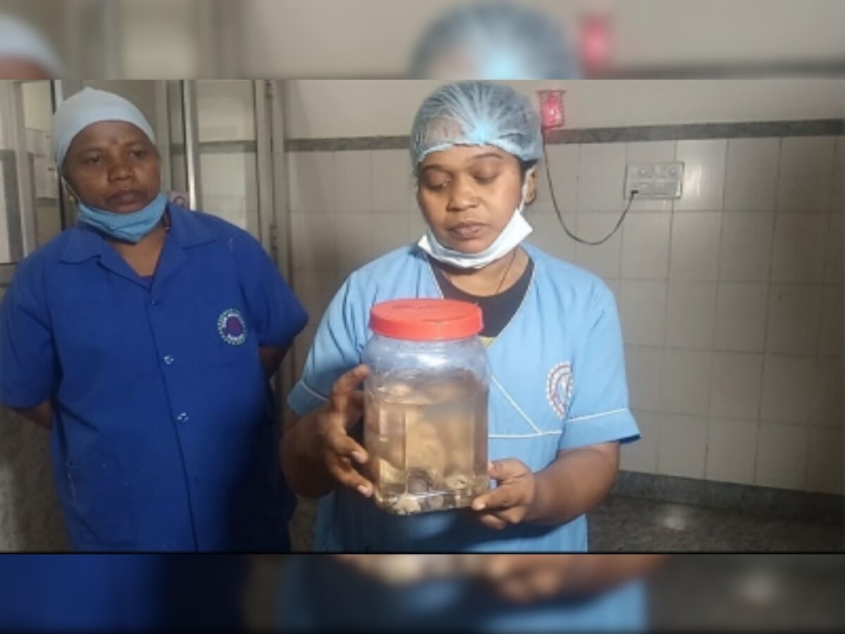 Ranchi में 23 दिन की बच्ची के पेट में मिले आठ भ्रूण, डॉक्टर बोले- यह दुनिया का पहला केस