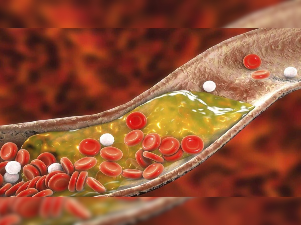 Cholesterol Diet: कोलेस्ट्रॉल आपकी जिदंगी को कर देगा तबाह, काबू करने के लिए शामिल कर लें ये चीजें