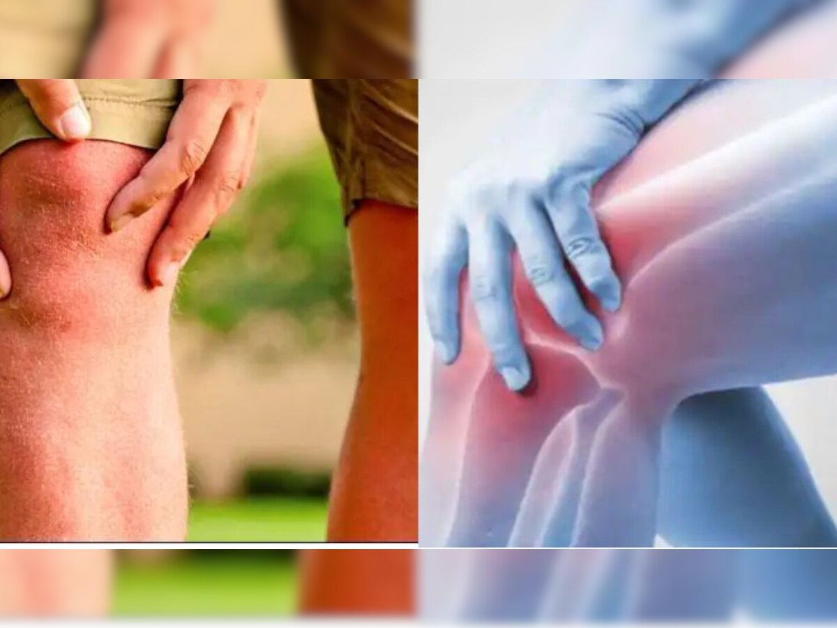 Joint pain: सर्दियों में क्यों बढ़ जाती है हड्डियों में जकड़न, इग्नोर करना पड़ सकता है भारी