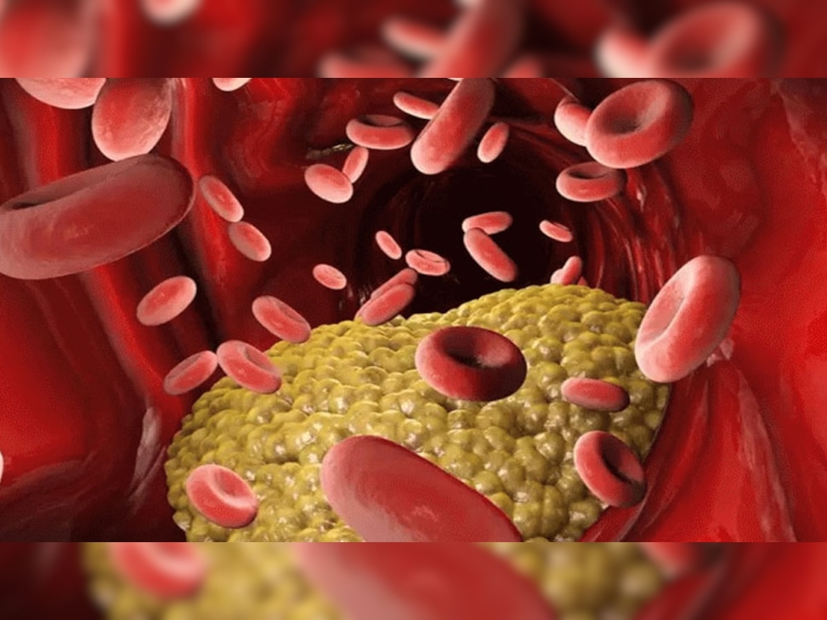 Cholesterol Control Tips: जब शरीर में बढ़ जाए बैड कॉलेस्ट्रॉल तो भूलकर भी न करें ये 4 गलतियां, जिंदगी के पड़ सकते हैं लाले