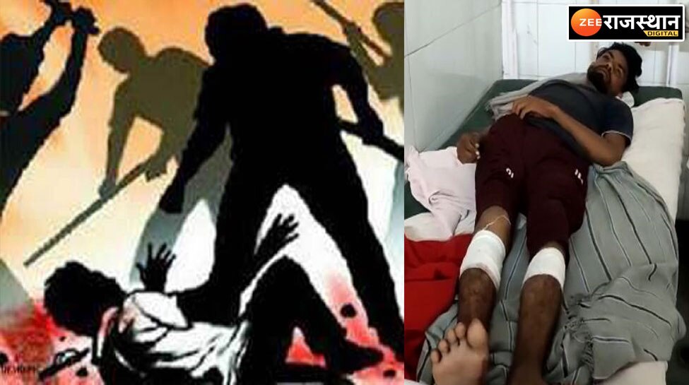 मालवीय नगर के पास बाइक सवार युवक को लाठी डंडो से पिटते रहे आधा दर्जन बदमाश, युवक का दोनों पैर फ्रैक्चर