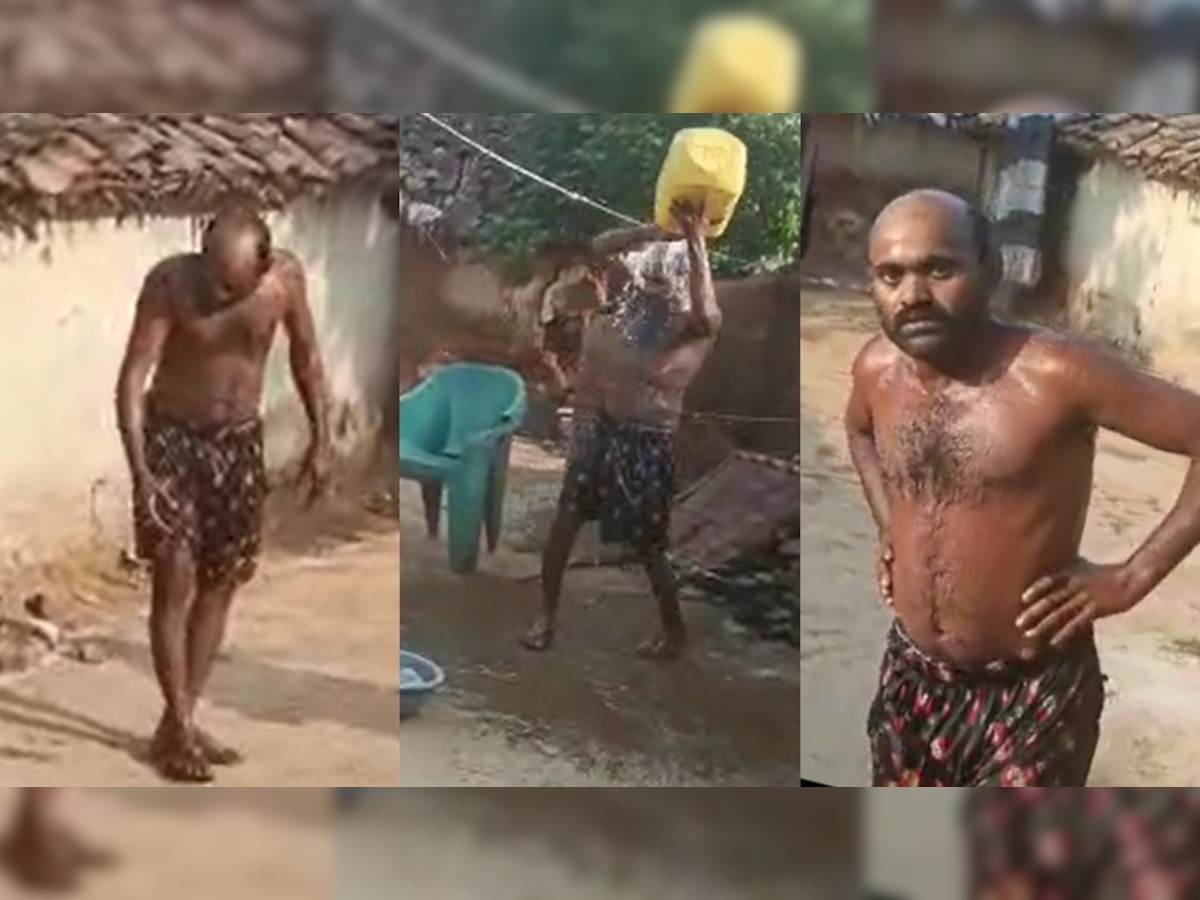 उल्टा चोर कोतवाल को डांटे: घर में बना रहा था शराब, पुलिस पहुंची तो डाला लिया खौलता पानी