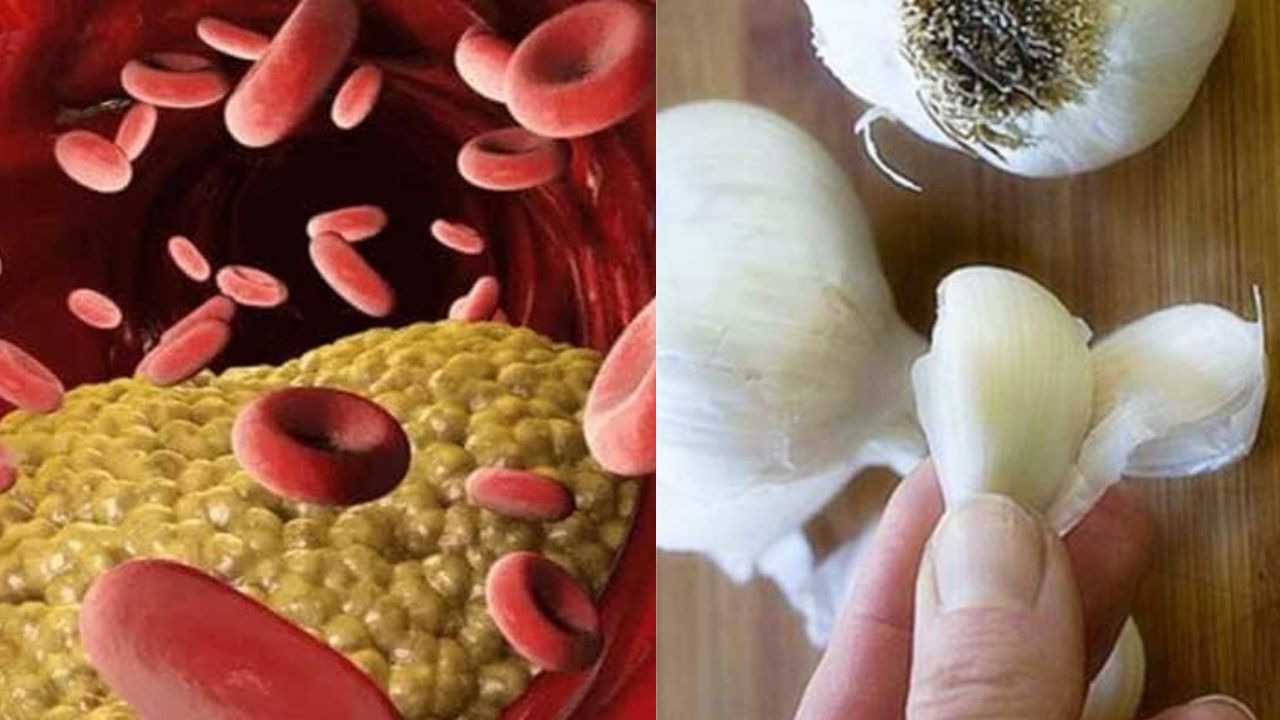 Garlic is considered very beneficial in high blood pressure its works