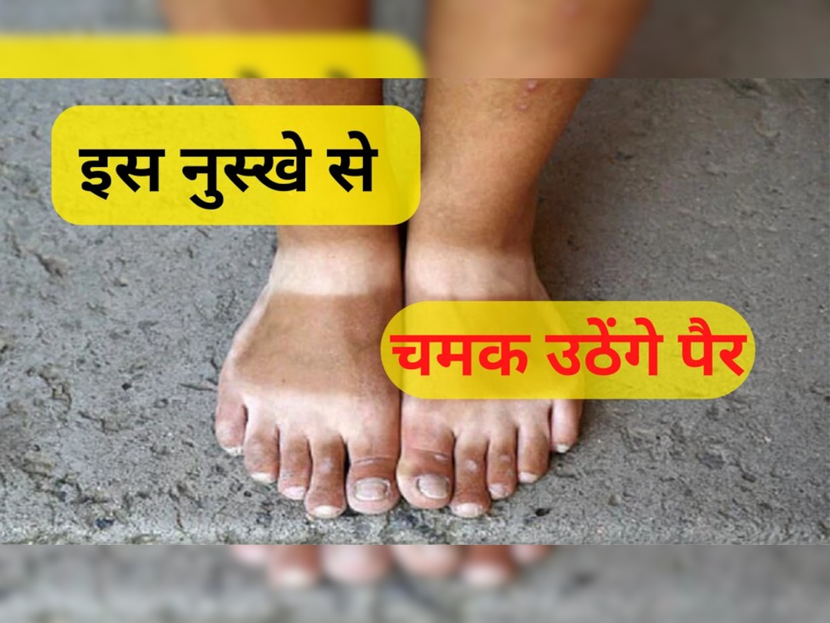 Feet Tanning: पैरों का कालापन सिर्फ 20 मिनट में होगा साफ, अगर अपनाएंगे ये 5 घरेलू उपाय 