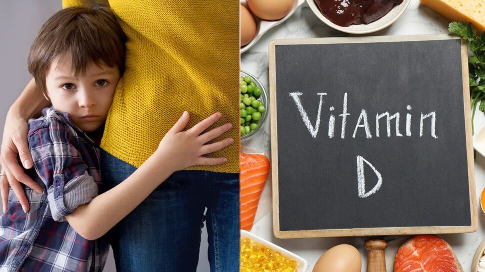 Vitamin D Deficiency in Children Kids Major Disease Rickets Weak