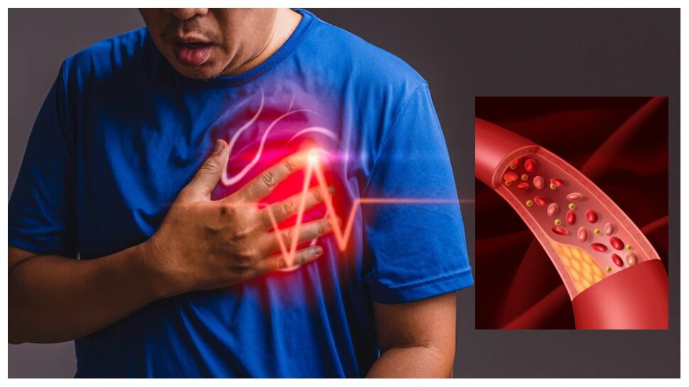 How To Control High Blood Pressure And Cholesterol In Winter Season 