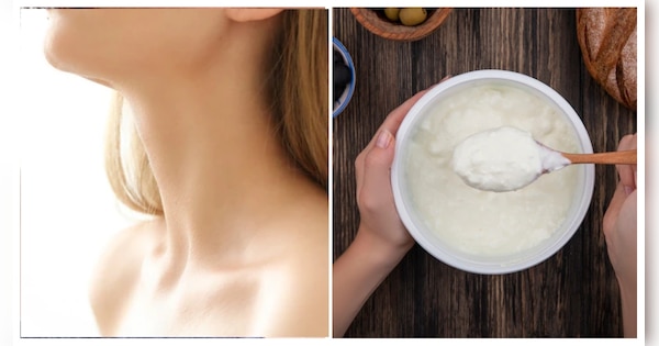 how-to-remove-sun-tan-from-face-neck-natural-ways-to-get-rid-sun-tan