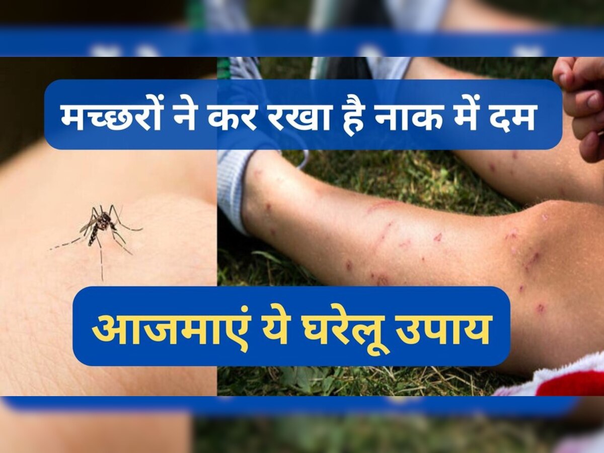 Home remedies for mosquito: मच्‍छरों के काटने से बच्‍चे हो जाएंगे बीमार, दूर भगाने के लिए तुरंत करें ये घरेलू उपाय