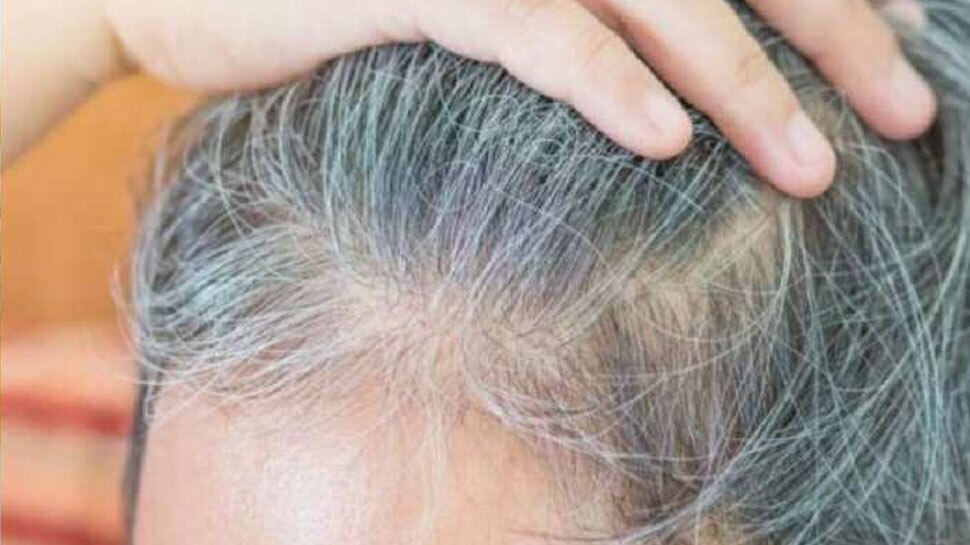 white-hair-solutions-remedies-to-make-white-hair-black-naturally
