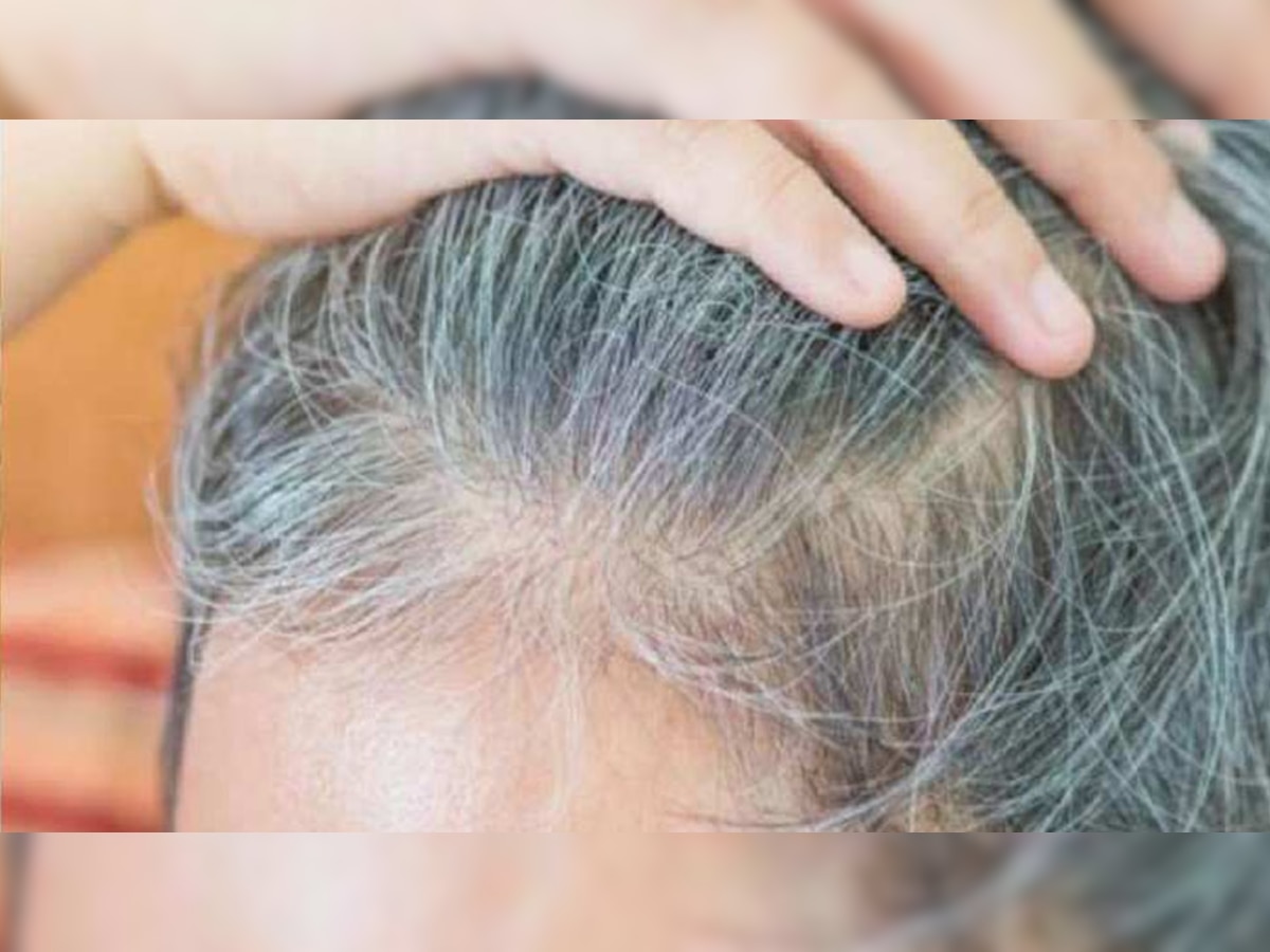 White Hair Solutions: कम उम्र में सफेद होते बालों से हैं परेशान? अपना लें ये 4 घरेलू उपाय, पहले की तरह आ जाएगी रौनक