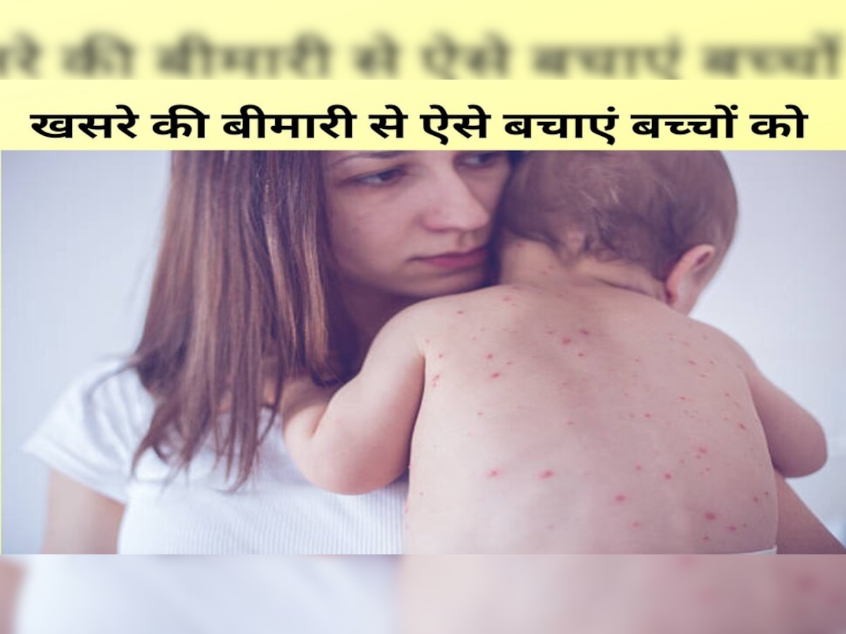 Measles virus: बच्चों पर खसरा बीमारी का खतरा मंडराया, मुंबई में फैल रहा संक्रमण; ऐसे करें बचाव  