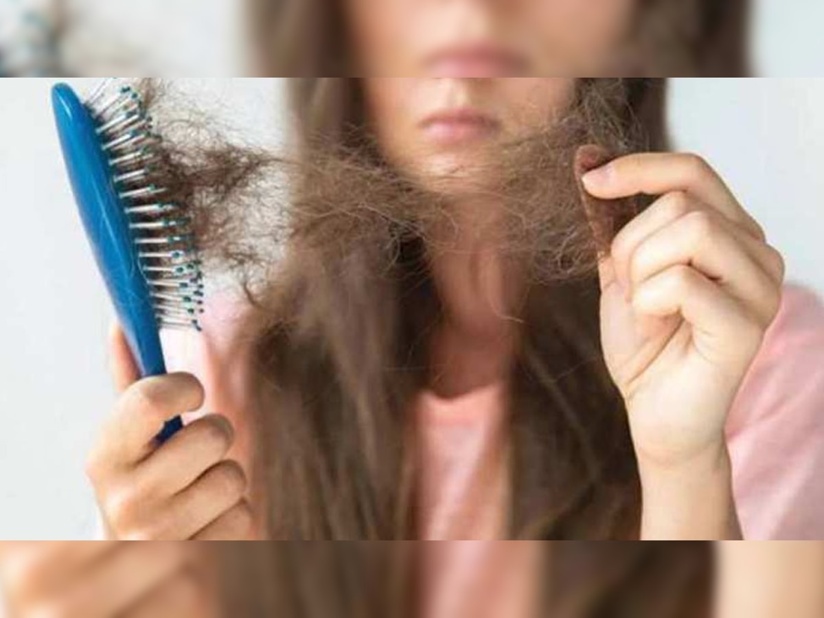 Hair Care Tips: बाल झड़ने की समस्या से चाहते हैं मुक्ति? नारियल तेल में मिलाकर लगाएं ये 3 ऑयल, जड़ें हो जाएंगी मजबूत