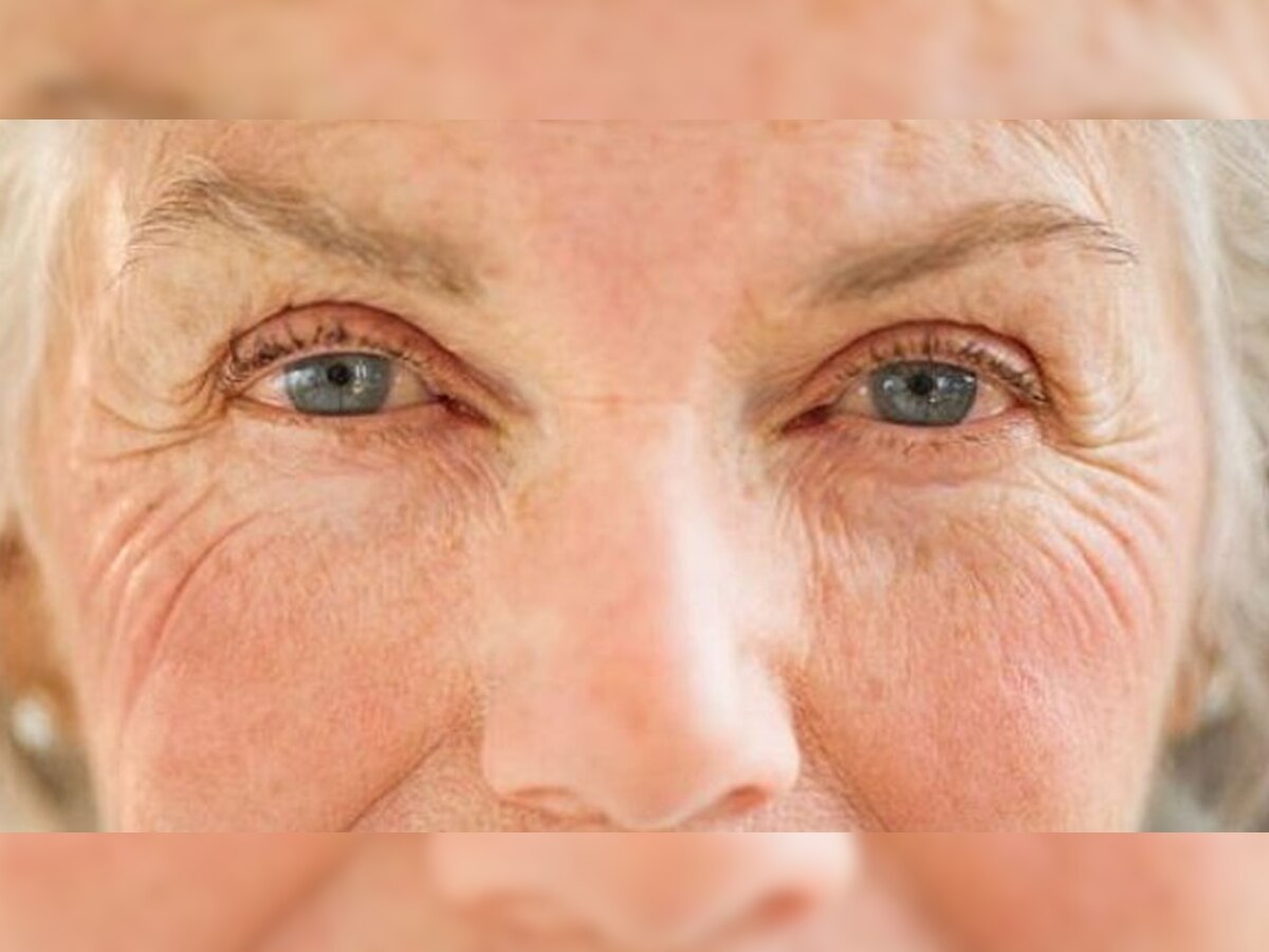 Wrinkle Cure Diet: चेहरे की झुर्रियों को कम करने के लिए शुरू कर दें इन 5 चीजों का सेवन, फिर से दमकने लगेगा मुखड़ा