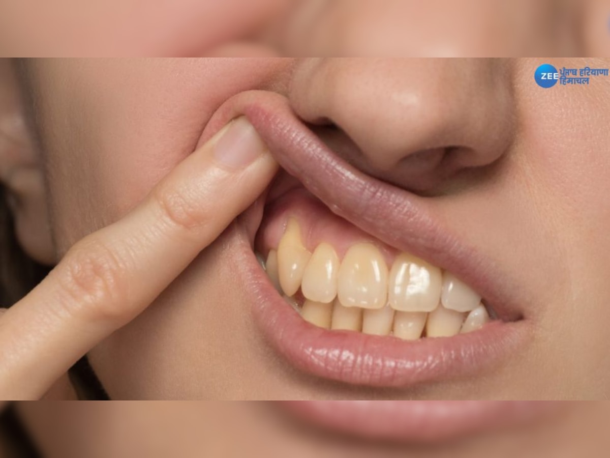Teeth Whitening: ਪੀਲੇ ਦੰਦਾਂ ਤੋਂ ਹੋ ਪਰੇਸ਼ਾਨ ਤਾਂ ਅਪਨਾਓ ਇਹ ਖ਼ਾਸ ਘਰੇਲੂ TIPS