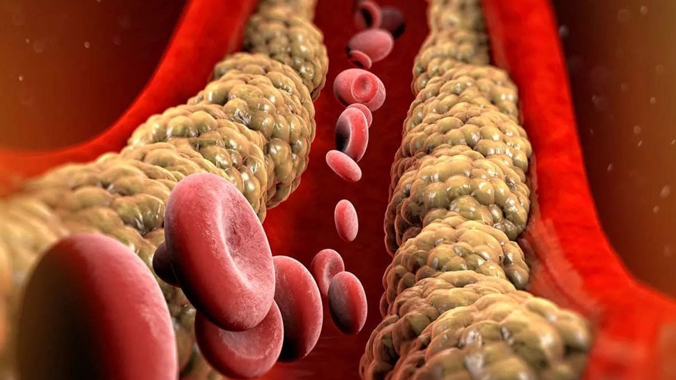 Cholesterol Remedies: हाई कोलेस्ट्रॉल से चाहते हैं मुक्ति? सुबह उठते ही इन चीजों का शुरू कर दें सेवन, मोम की तरह पिघल जाएगी चर्बी