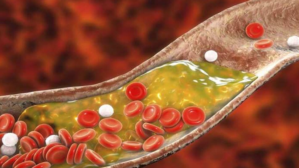 Cholesterol Control Juice: हाई कोलेस्ट्रॉल ने कर रखा है परेशान? शुरू कर दें इन 4 हेल्दी ड्रिंक्स का सेवन, बर्फ की तरह पिघल जाएगी बीमारी