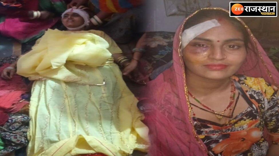 Bhim Rajsamand Image Bhim Rajsamand News mother in law hit cooker on daughter in law head ...