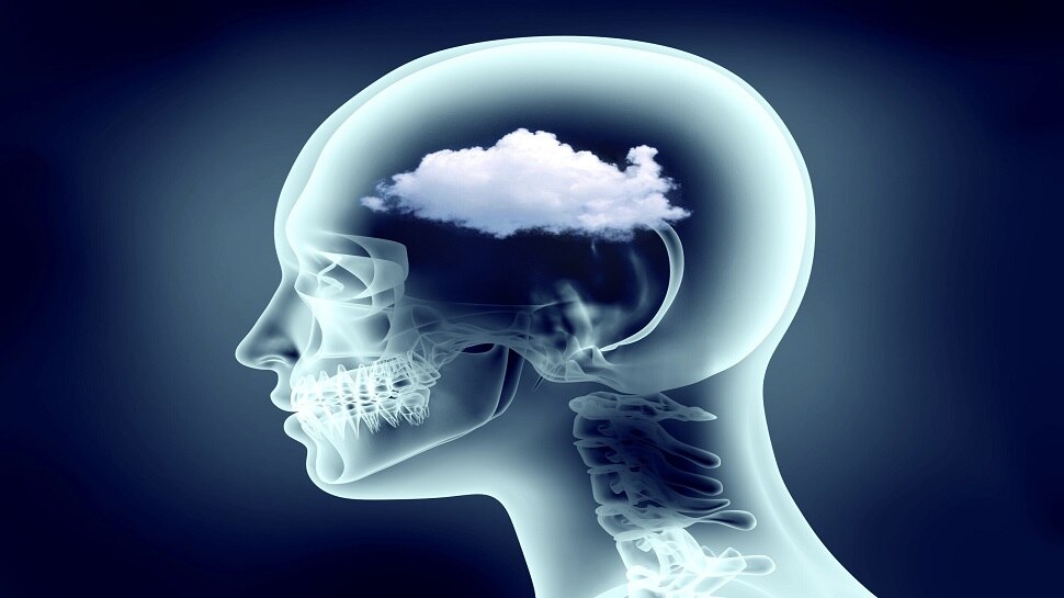 Health Tips: ଜାଣନ୍ତୁ Brain Fog କ'ଣ, ଏହାର କାରଣ, ଲକ୍ଷଣ ଓ ଚିକିତ୍ସା ପଦ୍ଧତି