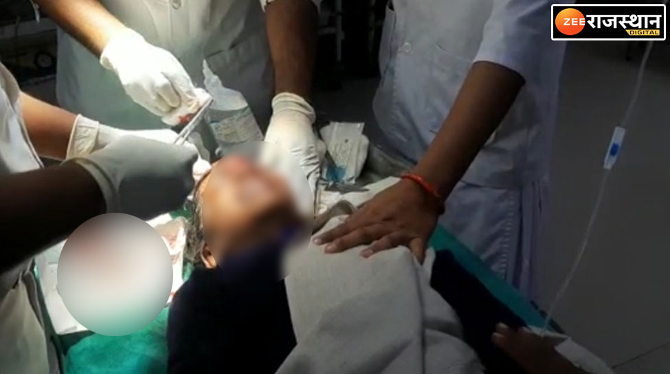 पाटन में बच्चों को स्कूल ले जा रहा ऑटो पलटा, दुर्घटना में 9 मासूम घायल, एक कोमा में