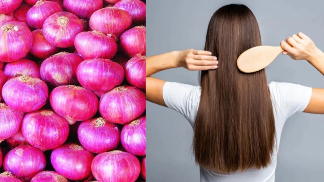 Benefits of onion: इस कारगर नुस्खे से बालों को मिलेगी नई जिंदगी, देखते ही देखते हो जाएंगे घने और लंबे