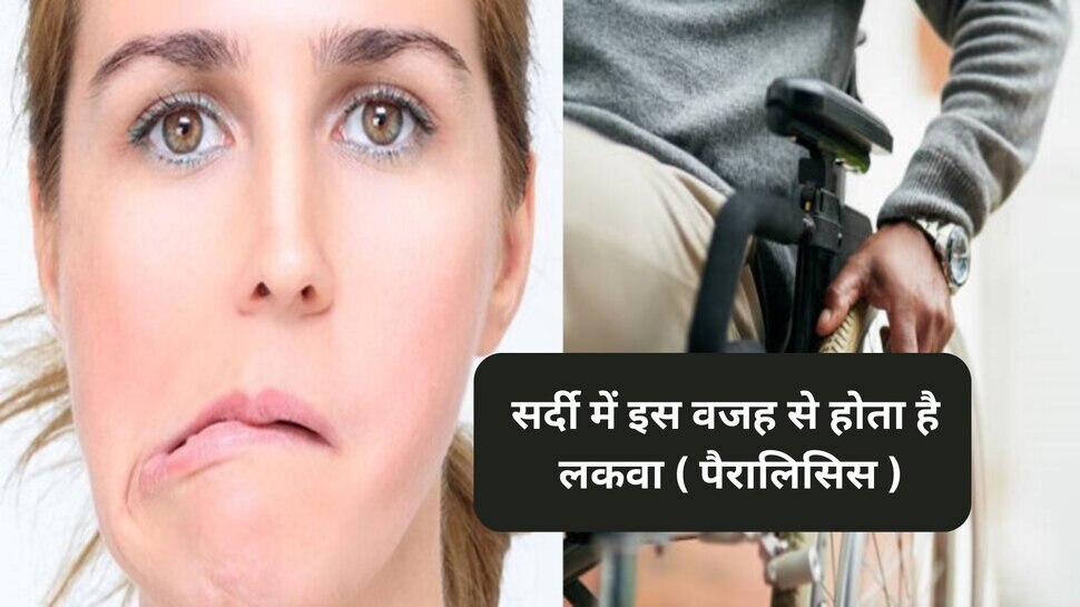 facial paralysis in winter season risk of paralysis in hindi
