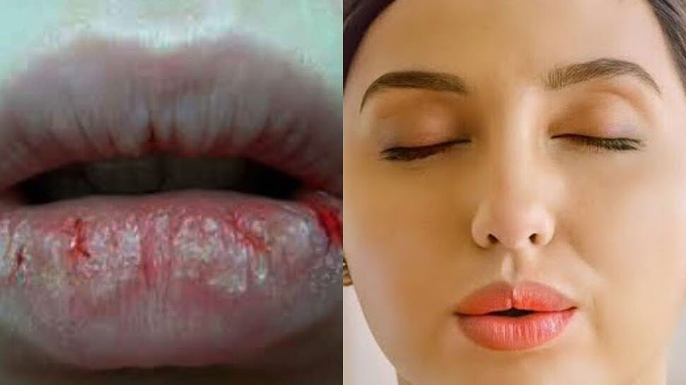 Nora Fatehi Why Lips Dry in Winter Season Main reason Sardiyon Me Kyon