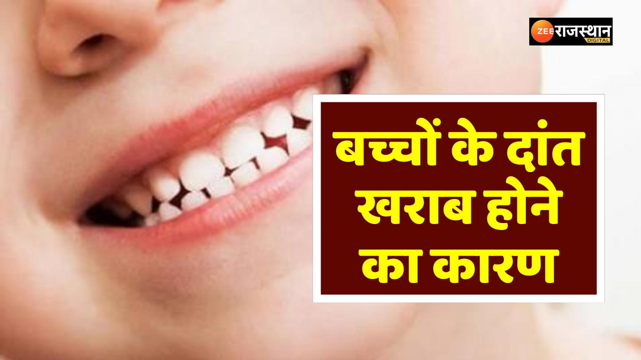 health-tips-why-do-children-get-bad-teeth-at-a-young-age-health-tips