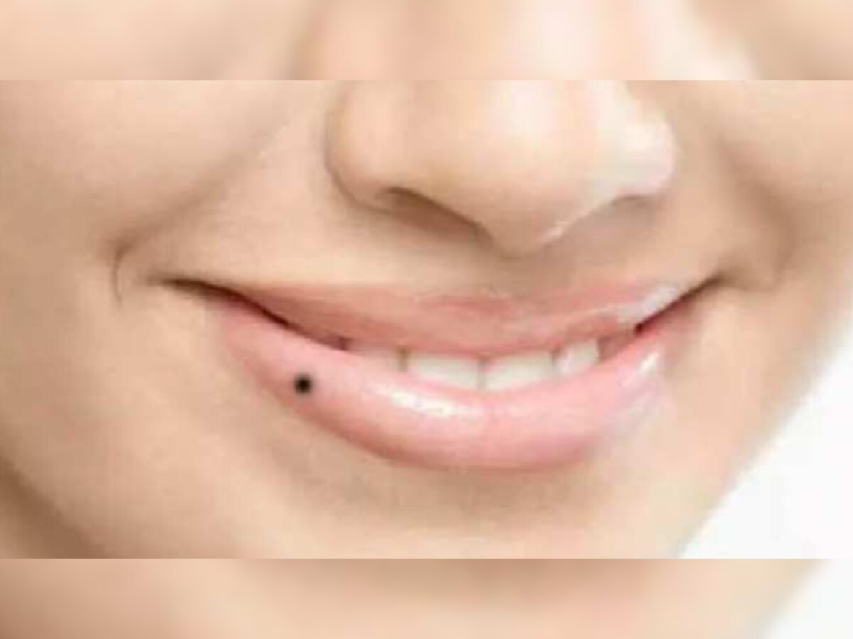 til-on-body-meaning-hindi-til-on-nose-palm-urdu-2014-2015-2016