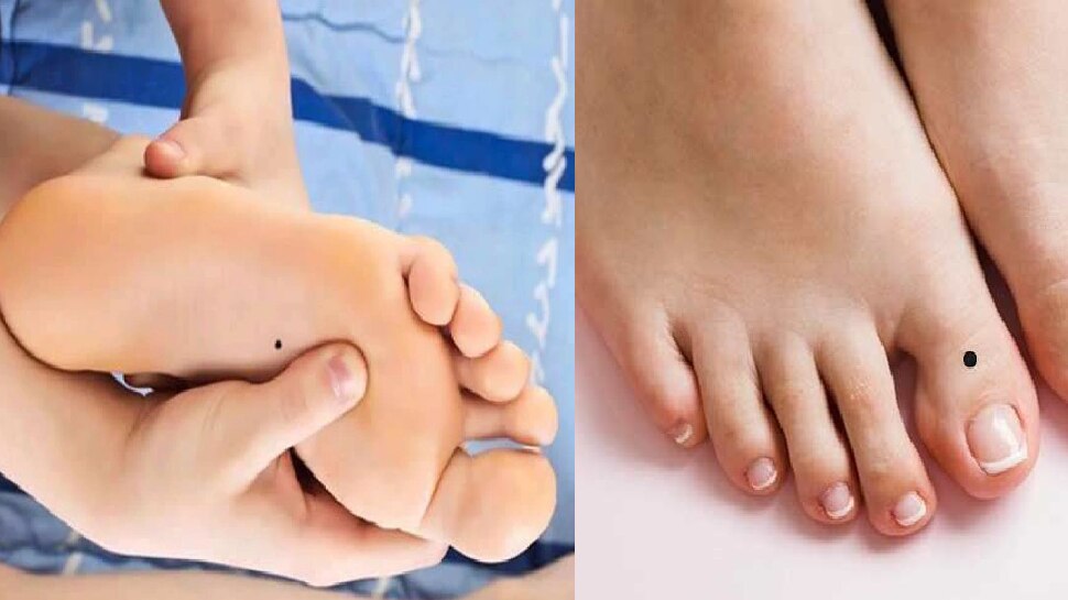 Lucky Moles on male female Body Meaning live life like a king til ka