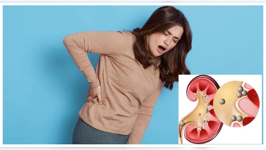 what are the symptoms of kidney stone pathri ke lakshan | Kidney Stone ...