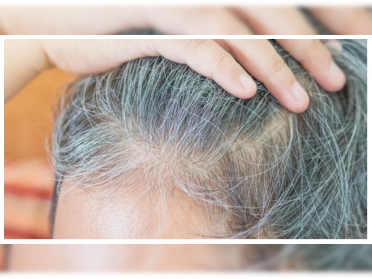 Grey Hair: कम उम्र में ही बाल हो रहे हैं सफेद? इन आसान तरीकों से दिक्कत होगी दूर