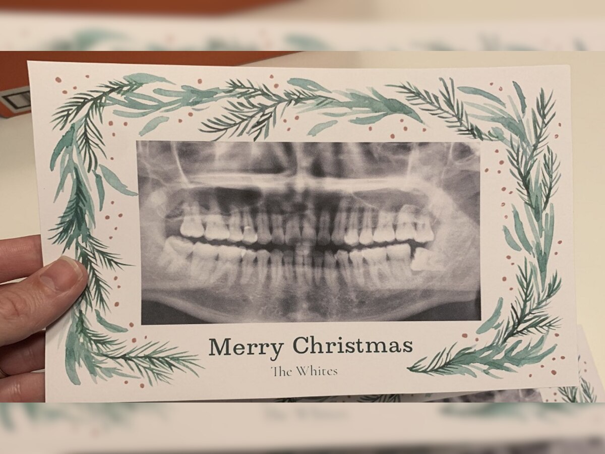 Merry Christmas: क्रिसमस कार्ड पर गलती से प्रिंट हुआ दांत का एक्सरे, जैसे ही शख्स को गिफ्ट दिया...