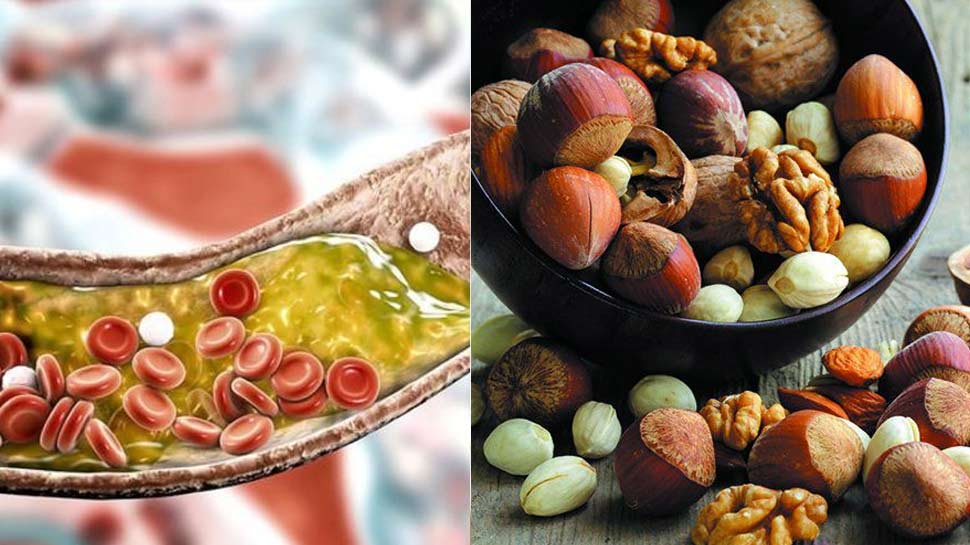 dry-fruits-for-reducing-bad-cholesterol-in-blood-pistachio-almonds