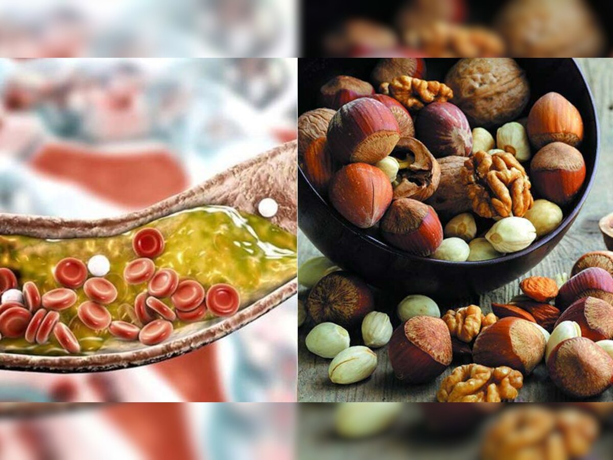 High Cholesterol की ऐसी तैसी कर देंगे ये 4 Dry Fruits, आप भी जान लीजिए उनके नाम