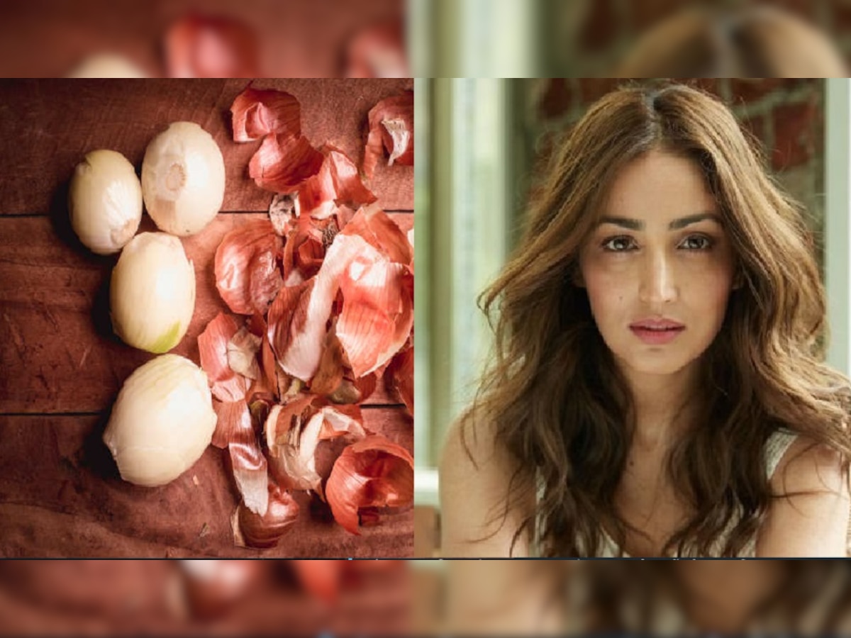 Onion Peel Benefits: प्याज के छिलकों में छिपे हैं सेहत और सौन्दर्य के राज, ऐसे यूज किया तो Yami Gautam की तरह चमकेगी स्किन