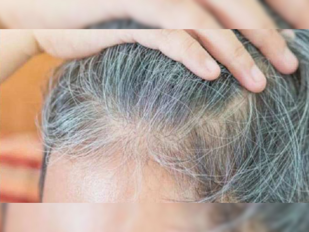 Hair Fall Solution: बालों के झड़ने और सफेदी से बढ़ रही चिंता? इस आसान घरेलू उपाय को अपना लीजिए, सभी परेशानियों से मिल जाएगी मुक्ति