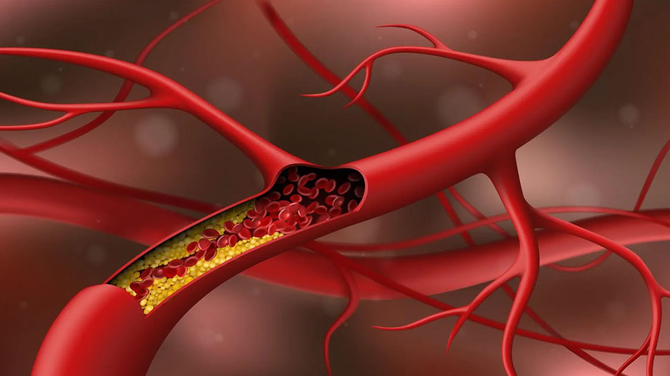 Cholesterol Control Food: बढ़ते मोटापे और कोलेस्ट्रॉल ने कर रखा है परेशान? शुरू कर दें इस देसी फूड का सेवन, जल्द मिल जाएगा फायदा Cholesterol Control Food: बढ़ते मोटापे और कोलेस्ट्रॉल ने कर रखा है परेशान? शुरू कर दें इस देसी फूड का सेवन, जल्द मिल जाएगा फायदा