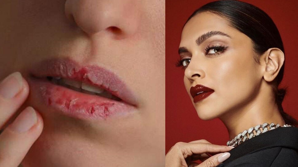 Deepika Padukone How To Cure Dry Lips With Natural Foods Almond Oil