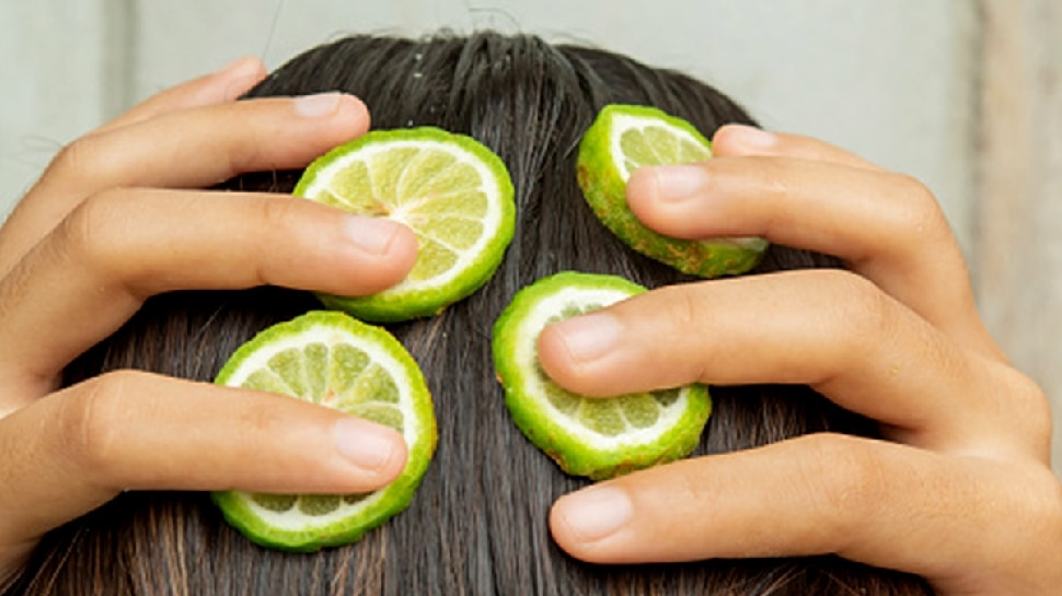 Scalp itching Treatment Effective Home Remedies Dandruff in head sir ki khujli ka ilaj sdmp | Scalp Itching Treatment: सिर की खुजली पका देती है दिमाग? ये घरेलू उपाय करेंगे आपकी मदद | Scalp itching Treatment Effective Home Remedies Dandruff in head sir ki khujli ka ilaj sdmp | Scalp Itching Treatment: सिर की खुजली पका देती है दिमाग? ये घरेलू उपाय करेंगे आपकी मदद |