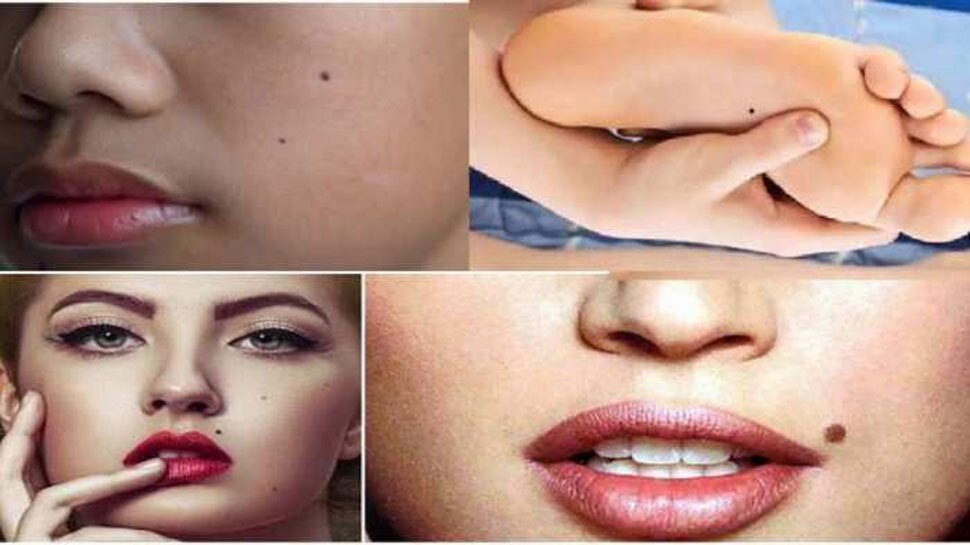 Lucky Moles on Body til ka matlab mole in these parts of body gives