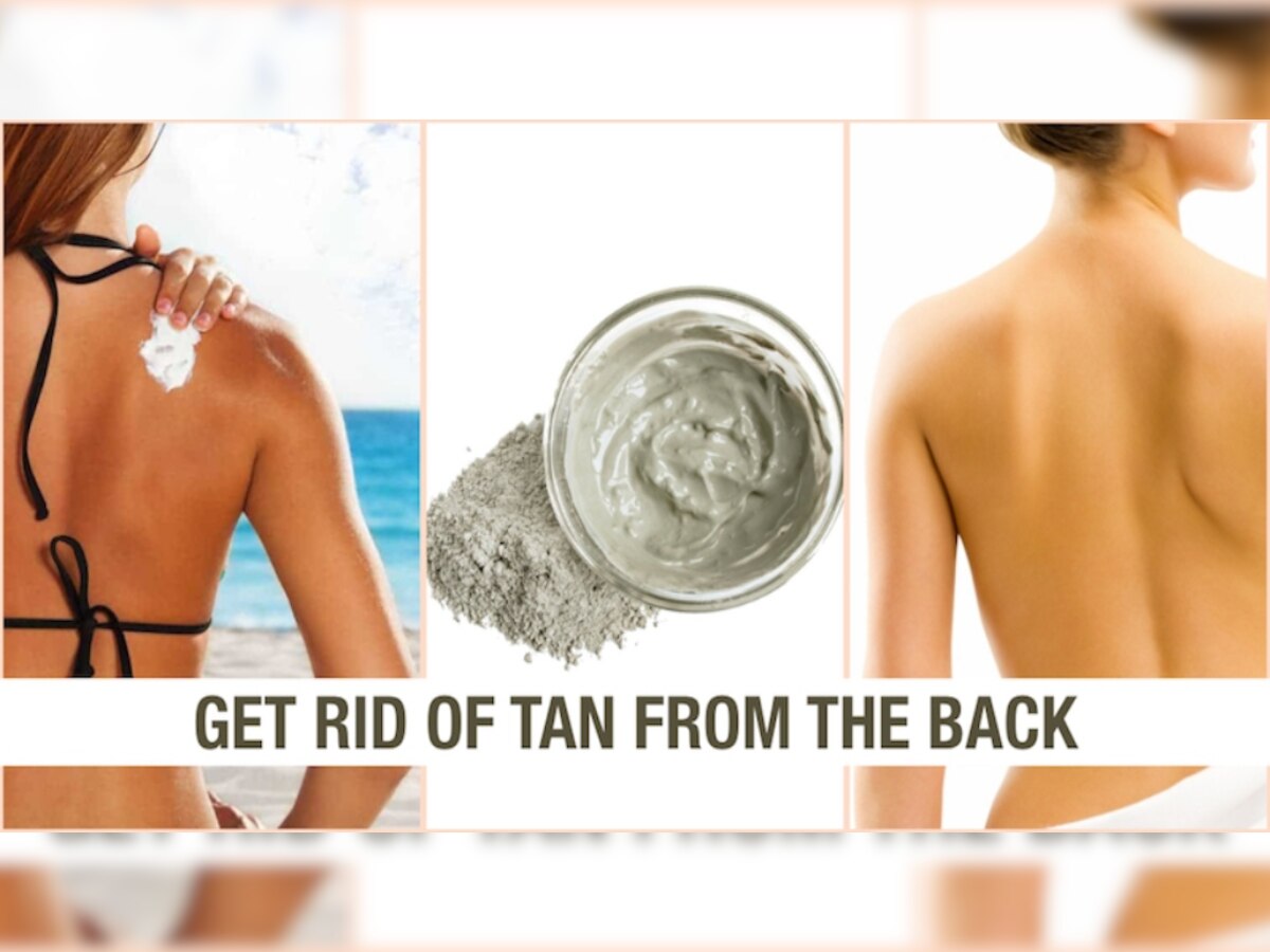 How To Get Rid Of Back Tanning: पीठ के कालेपन को तुरंत दूर कर देती हैं किचन में मौजूद ये 3 चीजें 