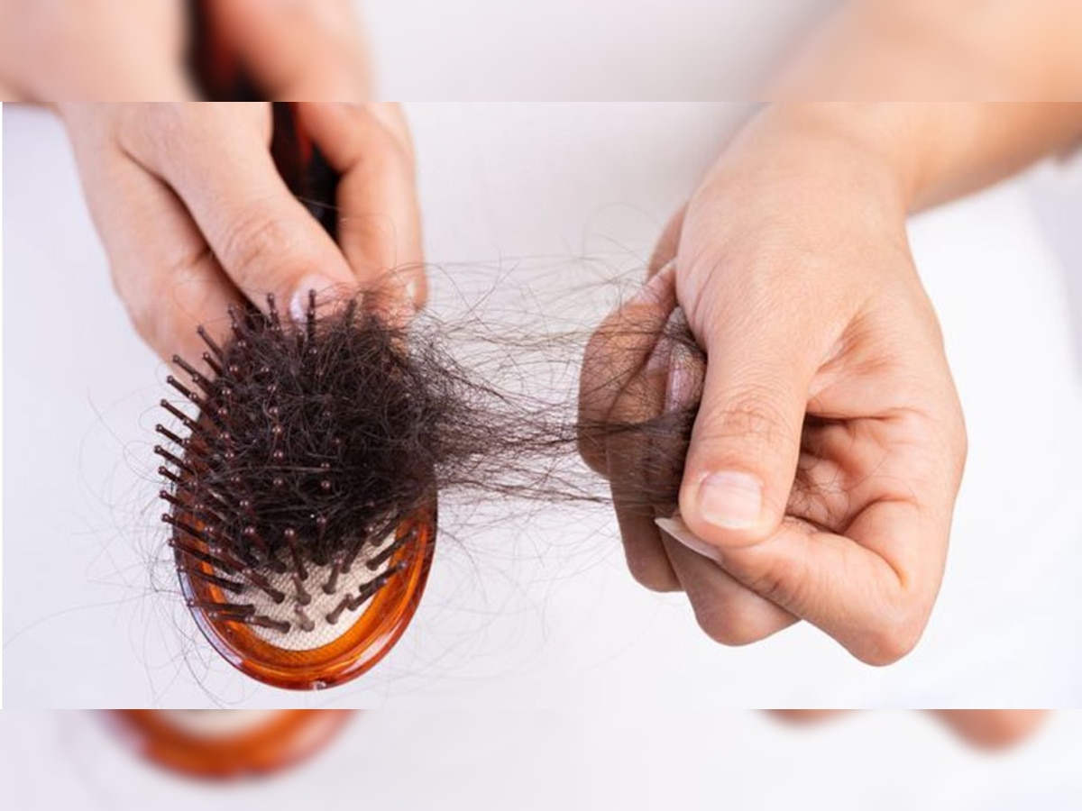 Hair Fall Remedies:  सिर पर घट रहे बालों की वजह से झेलनी पड़ती है शर्मिंदगी? अपना लें ये 5 घरेलू नुस्खे, फिर से आ जाएगी रौनक 