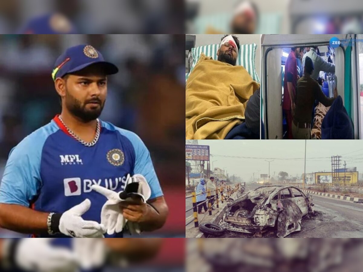 Rishabh Car Accident: ਰਿਸ਼ਭ ਪੰਤ ਦੀ ਹੋ ਸਕਦੀ ਪਲਾਸਟਿਕ ਸਰਜਰੀ, ਸਾਹਮਣੇ ਆਈ MRI ਰਿਪੋਰਟ! ਜਾਣੋ ਸਿਹਤ ਦਾ ਹਾਲ 