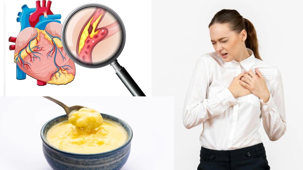 ghee-can-increase-bad-cholesterol-level-ghee-side-effects-cholesterol