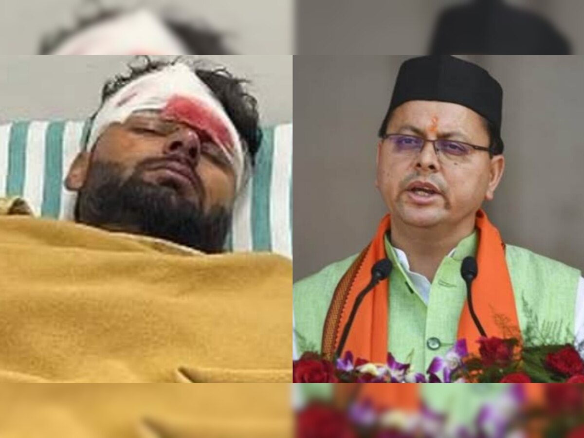 Rishabh Pant Accident: अस्पताल में ऋषभ पंत से मिले CM धामी, क्रिकेटर की जान बचाने वालों के लिए किया ये बड़ा ऐलान
