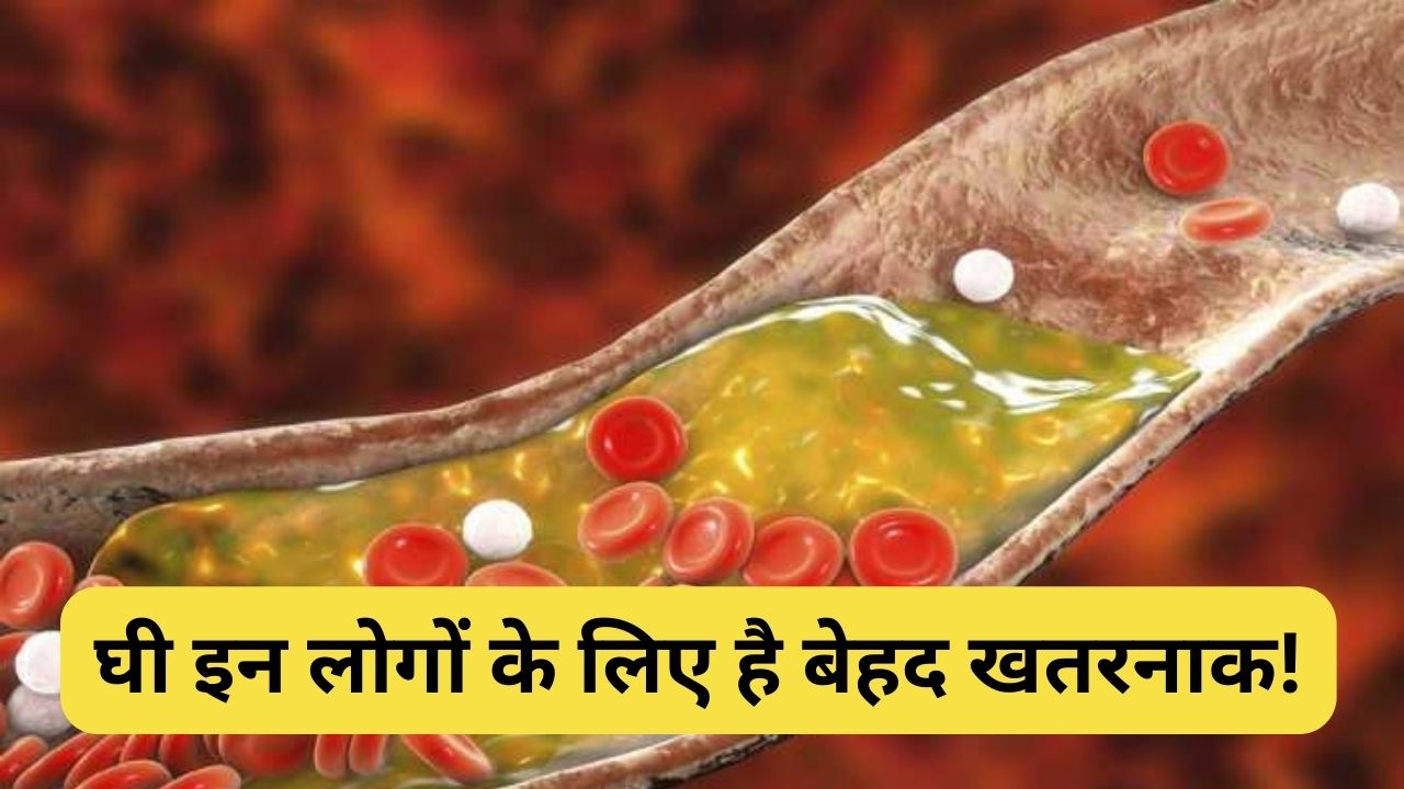 Consumption of ghee should be stopped under increasing bad cholesterol