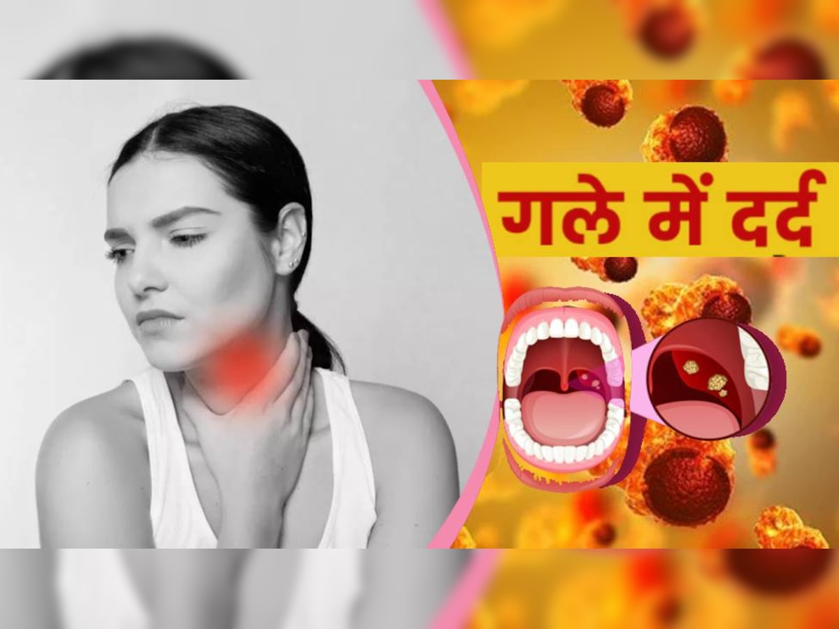 क्या ठंड की वजह से आपके गले में भी है दर्द, Tonsil Cancer के भी हो सकते हैं लक्षण, जान लें लक्षण